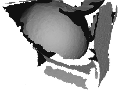 Dialface North